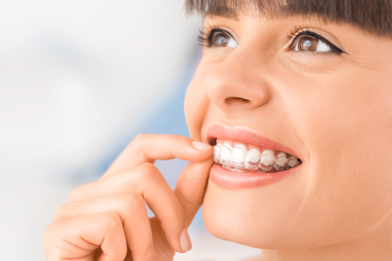 Invisalign in Lawrence Township